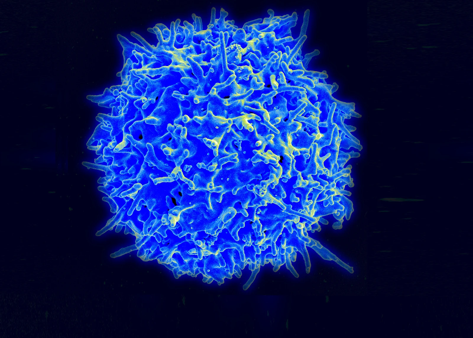 Scanning electron micrograph of a single healthy human T lymphocyte, a rounded cell covered in short surface projections, colorized blue on a dark background